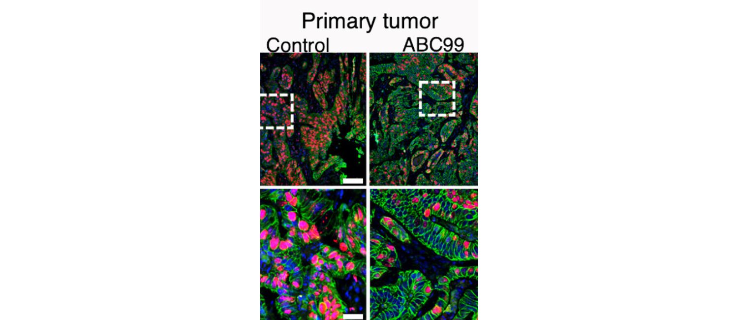 Fluorescent microscopy of colon cancer with and without NOTUM inhibition.