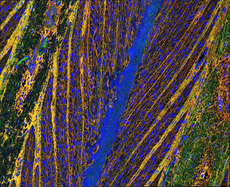  lamellar tissue sample stained for dermal connective tissue (COMP and WGA counterstain)