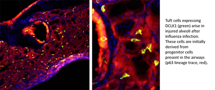 Tuft cells expressing DCLK1 arise in injured alveoli.