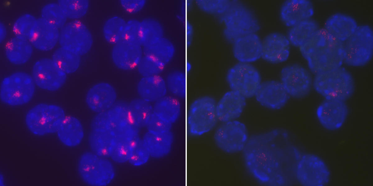 Researchers found that the protein YY1 brings Xist RNA back to the inactive X chromosome to maintain X chromosome inactivation in stimulated B cells. Activated, wild type B cells from female mice tightly localize Xist RNA at their inactive X chromosomes (left), whereas Xist RNA becomes dispersed throughout the entire nucleus when YY1 is deleted (right). 
