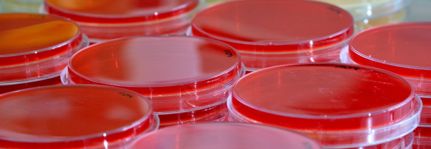 A group of red petrie dishes