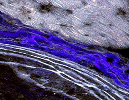UV light on glo germ on fecal cup