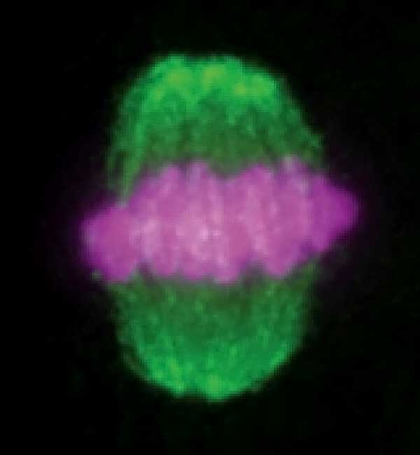 treating male infertility left