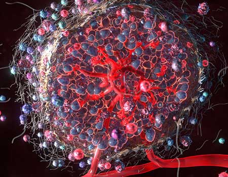 tumor microenvironment