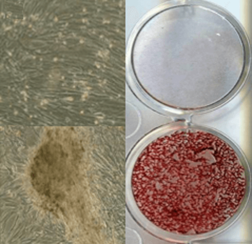 Collagen Matrix
