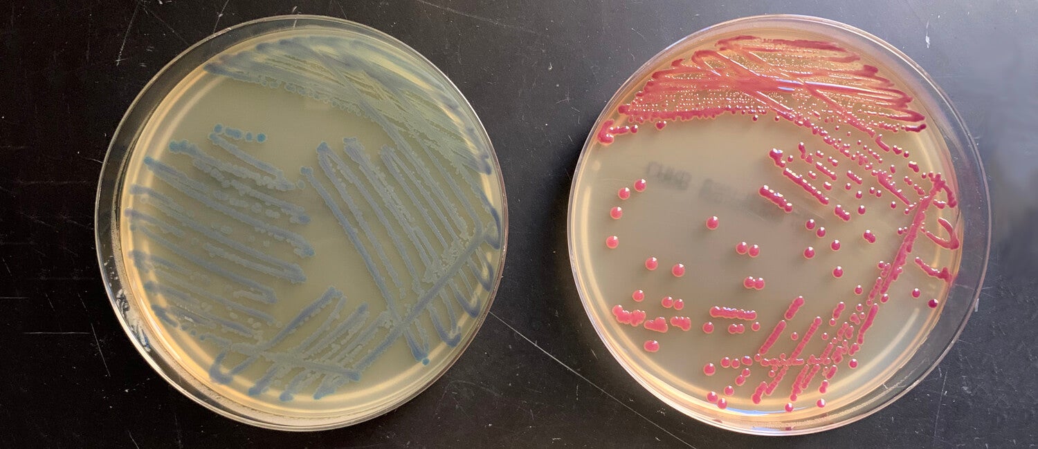 petri dishes