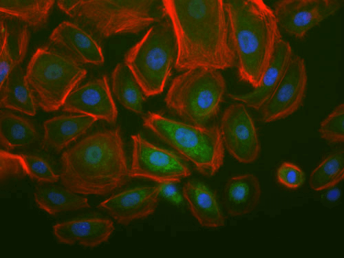 Human Keratinocytes Migrating In Culture