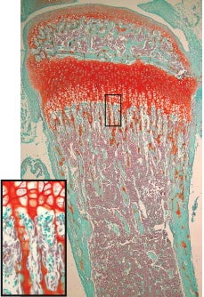 jacenko bone