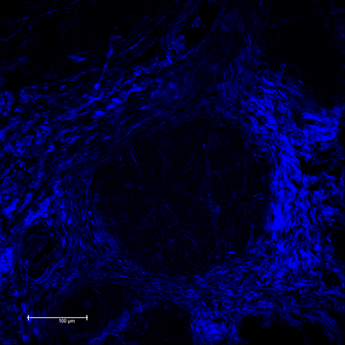Collagen Matrix