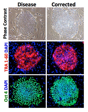Human induced pluripotent stem cells