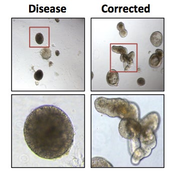 Human intestinal organoids