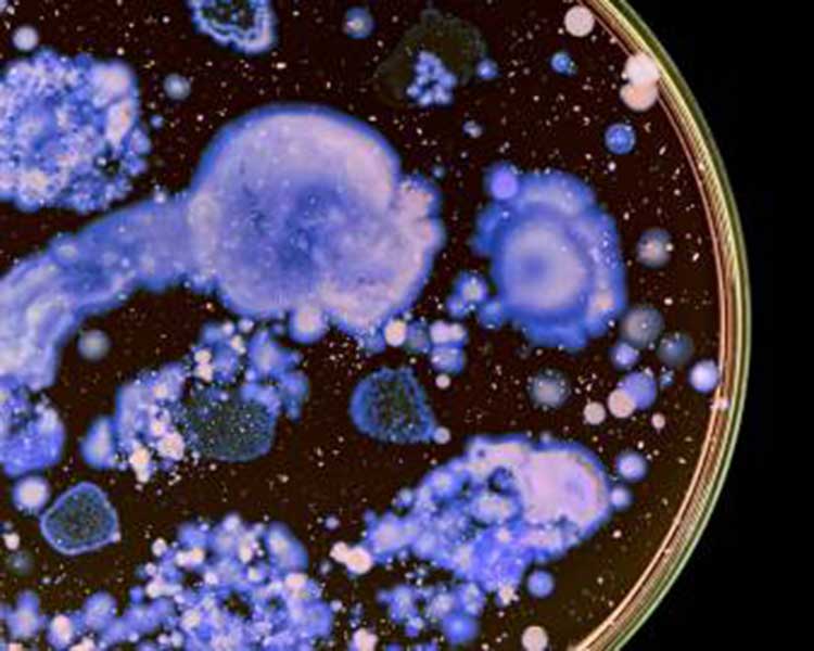 closeup of petri dish