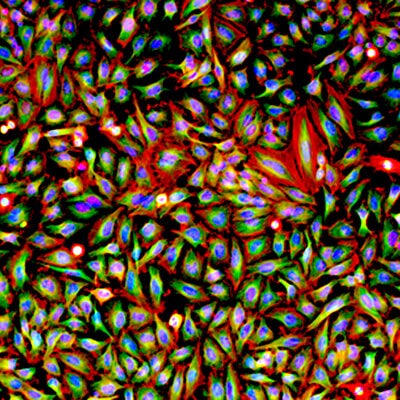laboratory slide