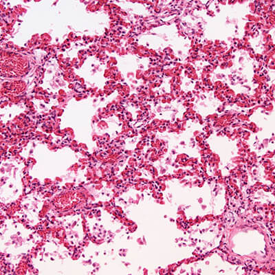 laboratory slide