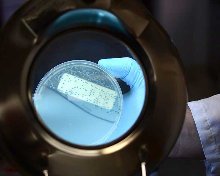 petri dish
