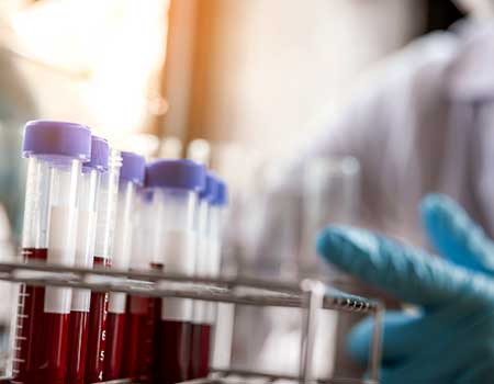 test tubes in lab