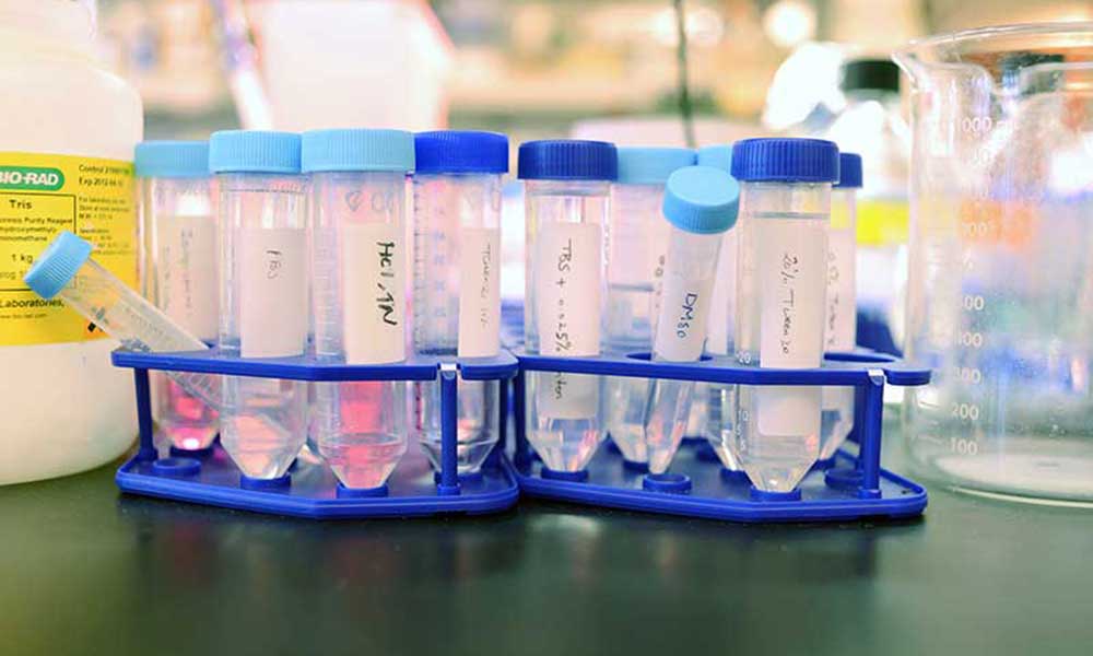 test vials