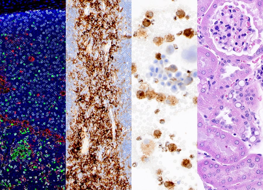 virus are researched at the Comparative Pathology Core