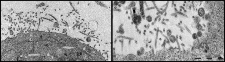 Low and high magnification electron micrographs showing budding of long, filamentous Ebola VP40 VLPs
