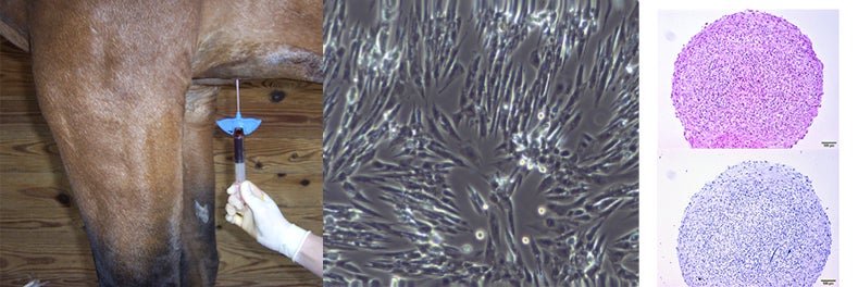 Harvesting Bone Marrow