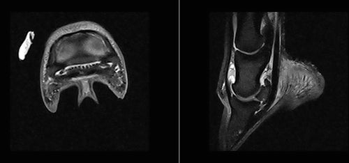 Lexi New Mri