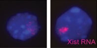 Lymphoid DCs