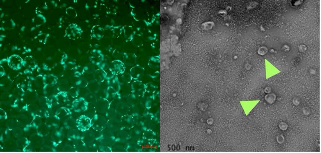 Mesenchymal stem cells