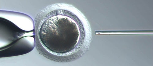 An equine egg (oocyte) being held by a holding pipette