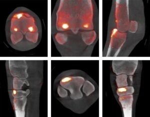 Images of a CT/PET Scan