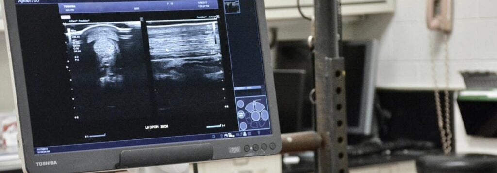 X-ray screen
