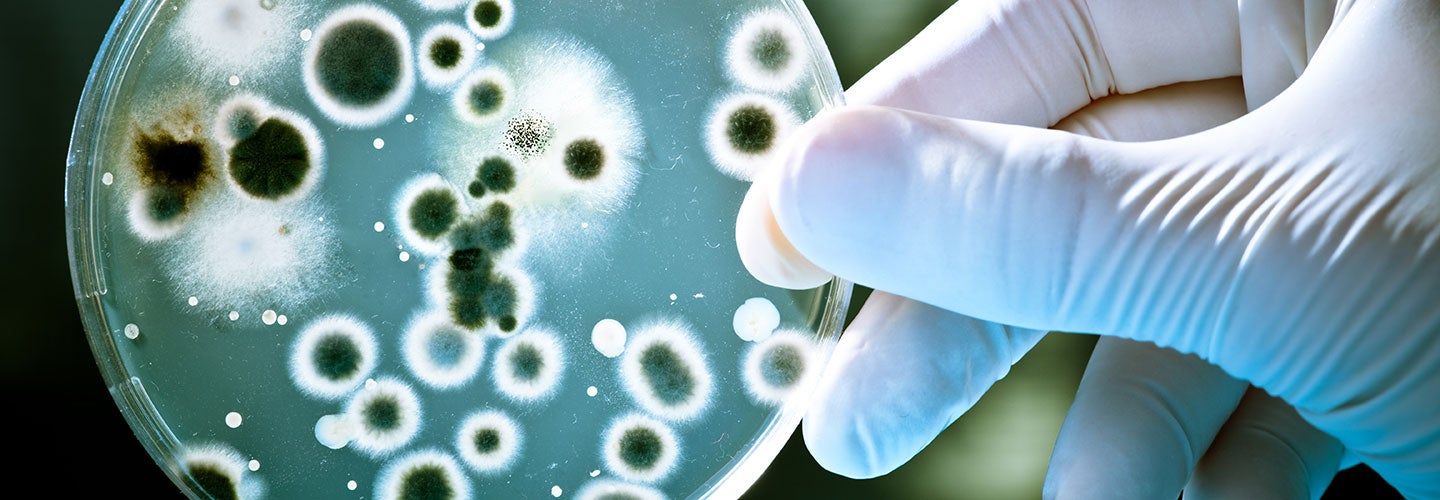 petri dish with bacterial colonies