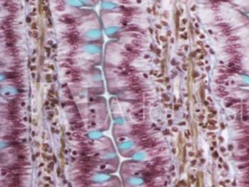 autoimmunity-and-inflammation