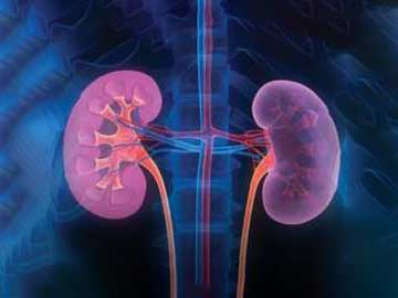 Kidneys Transplant