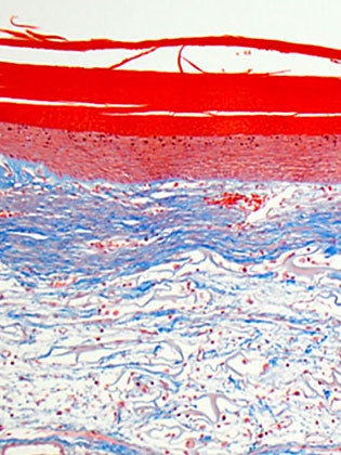 medical slide image