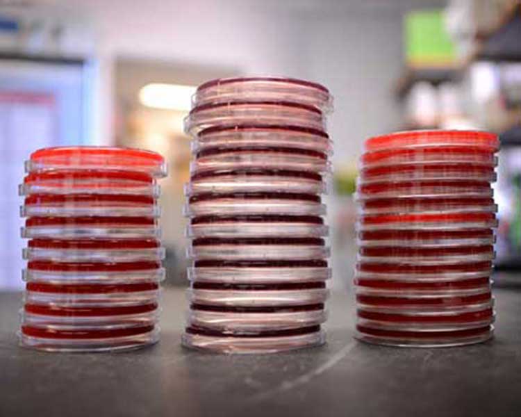 Red Petri Dishes