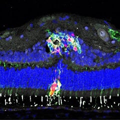 Replacing Photoreceptors