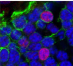 Retinal Cell regenerate