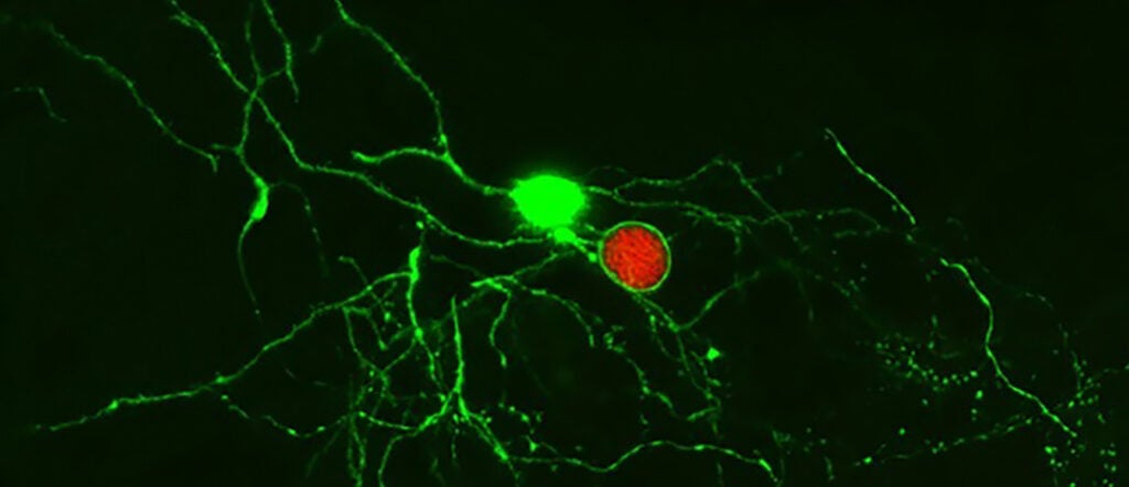 This image shows Toxoplasma gondii (red) and a neuron (green) in a mouse brain.