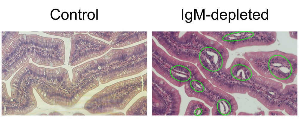 Gut Tissue damage induced by the lack of sIgM