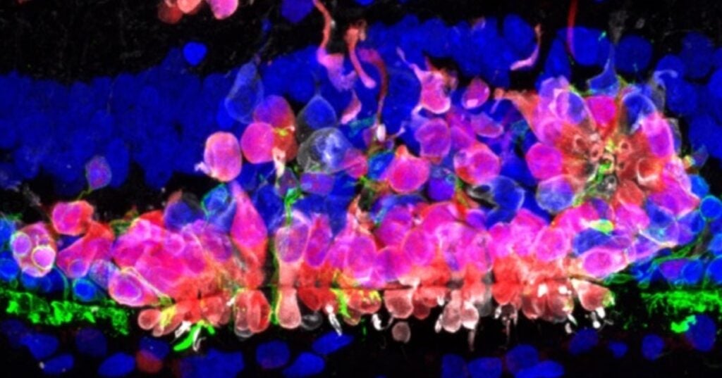 Photomicrograph shows a small number of transplanted human cells
