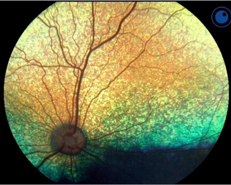 Fundus photography of a normal dog