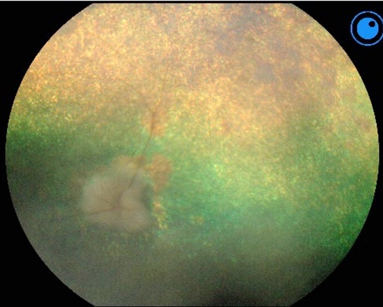 an image of a dog eye with pra