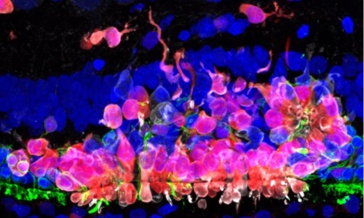 transplanted human cells red and blue image