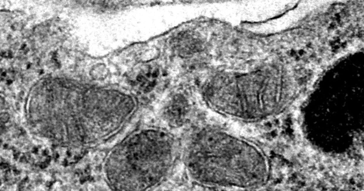 An image taken through scanning electron microscopy shows healthy mitochondria in brain endothelial cells from 22qDS animals treated with bezafibrate