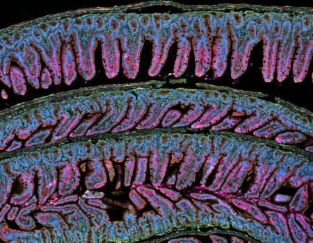 Close up photo of Spatial RNA.