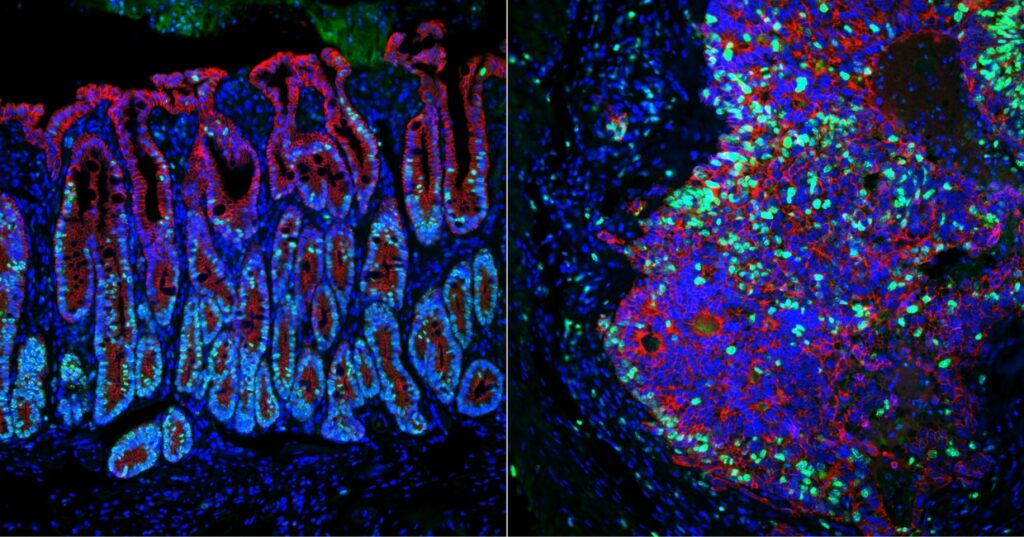 Histopathology tissue sections of the normal colon